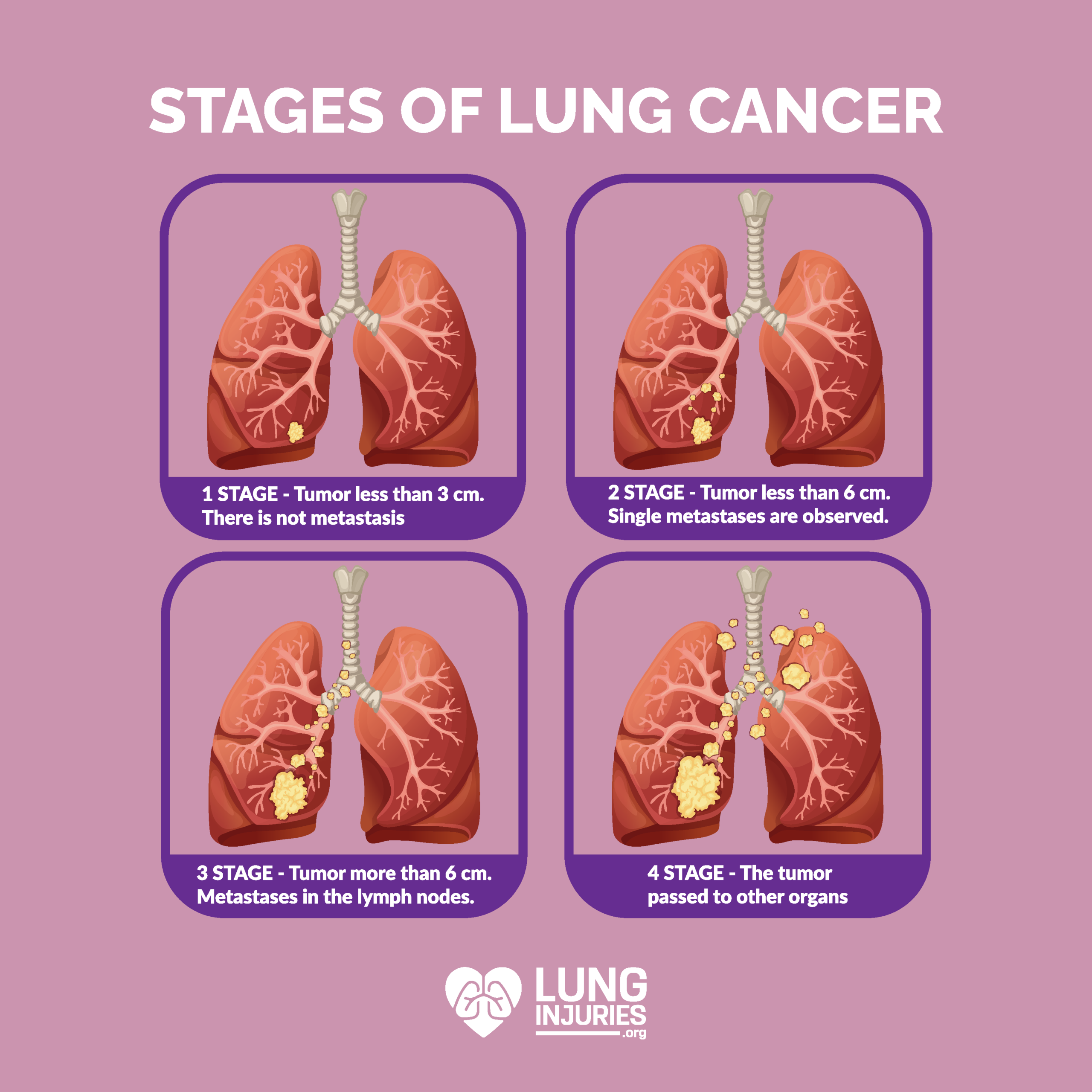 case study the lung cancer mystery